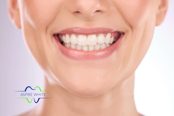 Follow your teeth whitening aftercare Chesham to prolong your whiter smile!